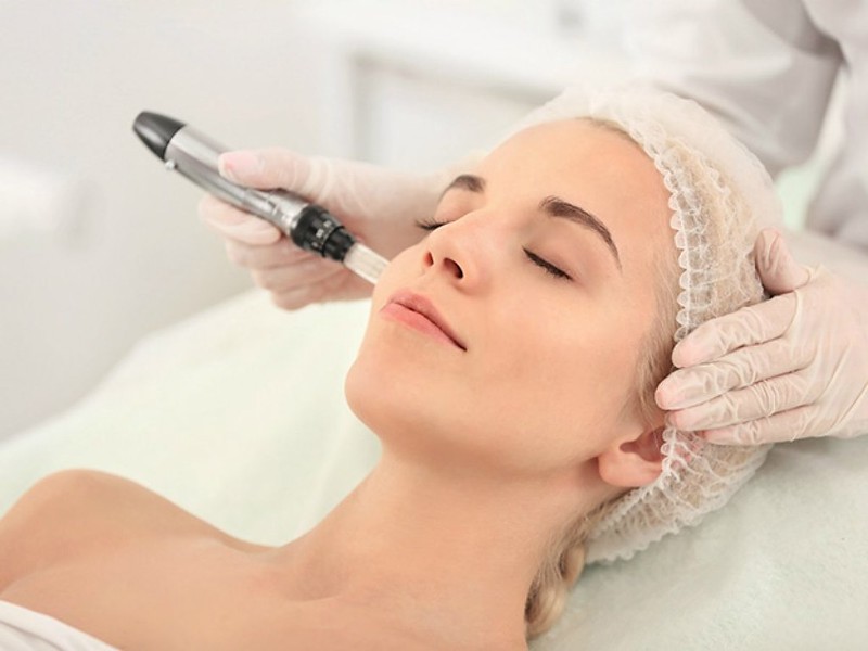 dermapen